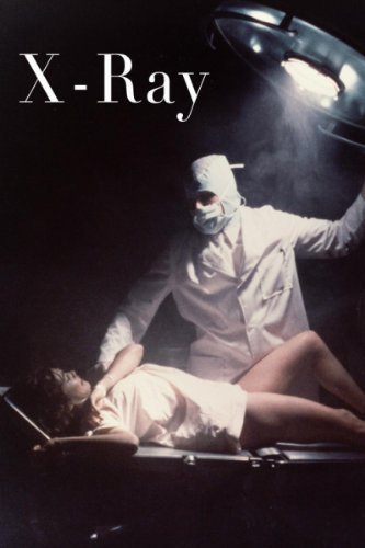 x ray movie review